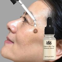 Kem tẩy nốt ruồi trị mụn cóc kem mụn cóc 7 ngày loại bỏ mụn cóc nhanh chóng Loại bỏ mụn cóc an toàn và không đau 20g