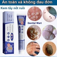 kem tẩy nốt ruồi trị mụn cóc kem mụn cóc 7 ngày loại bỏ mụn cóc nhanh chóng Loại bỏ mụn cóc an toàn và không đau 20ml