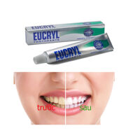 Kem trắng răng Eucryl toothpaste siêu tốc từ Anh 62gr