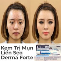 Kem Trị Mụn Derma Forte 15g