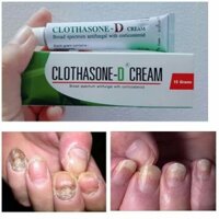 Kem Trị Nấm Móng Clothasone-D 15gr -Thái Lan