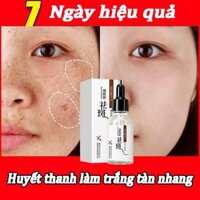 kem trị nám tàn nhang kem nâng tông da mặt thuốc trị nám tàn nhang chống lão hóa nhanh Làm trắng  kem dưỡng