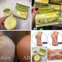 KEM TRỊ NỨT GÓT CHÂN BANANA 100% TỰ NHIÊN