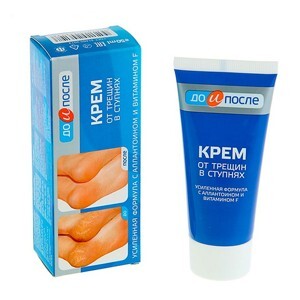 Kem trị nứt gót chân Kpem Apteka Nga 50ml