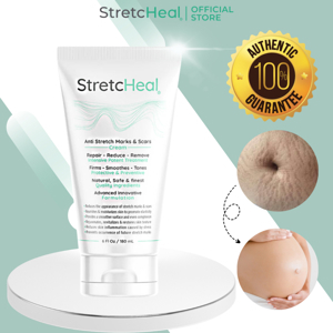 Kem trị rạn da Stretcheal 180ml