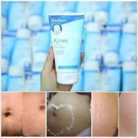 Kem trị rạn Gerber
