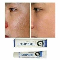 Kem trị sẹo Klirvin Nga 25g