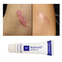 Kem trị sẹo Scar Rejuvasil Scar Heal 10ml Mỹ