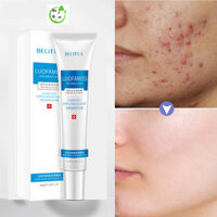 kem trị thâm mụn  Giảm Thâm Mụn Kem mụn mặt nạ giảm mụn Kem Giảm Mụn kem dưỡng giảm mụn 30g