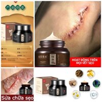 Kem xoá mờ sẹo 50g xóa sẹo thâm lồi, lõm, bỏng, thủy đậu, rạn da sau sinh , vết thâm mặt cải thiện làn da sáng mịn