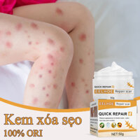 Kem Xoá Mờ Sẹo Lồi Lõm Bỏng Bôi Thủy Đậu Sẹo Lõm Sẹo Rỗ Sẹo Thâm - 50g - HTstore