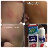 Lăn muỗi đốt Muhi cánh cụt 50ml