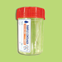 Lọ đựng nước tiểu