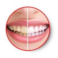 Lọ gel làm trắng răng CONG FANSDR Nhật Bản sản phẩm tẩy trắng răng an toàn tiện lợi, không tác dụng phụ khi sử dụng