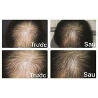 lotion bưởi calla