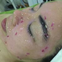 Mặt nạ collagen cánh hoa hồng dưỡng ẩm dưỡng trắng da