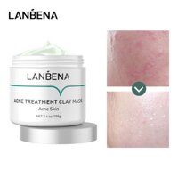 Mặt Nạ Đất Sét LANBENA Làm Sạch Sâu Kiểm Soát Dầu Cải Thiện Hiệu Quả 100g