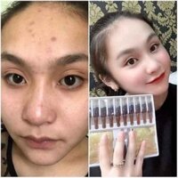 Mặt nạ thuốc bắc