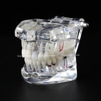 Mẫu hàm tư vấn bệnh lý nha khoa