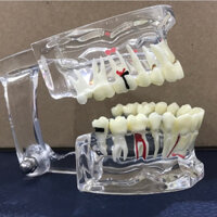 Mẫu hàm tư vấn bệnh lý toàn diện 5 trong 1 kích thước lớn