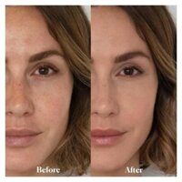 (Mẫu Mới) Phấn phủ Laura Mercier Translucent Loose Setting Powder