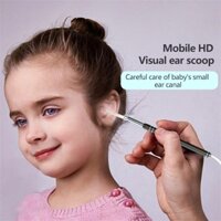 Máy Lấy Ráy Tai Có Camera Kết Nối Với Điện Thoại(Android/PC) 3 Trong 1, Nội Soi Tai, Mũi Họng - Có App full HD