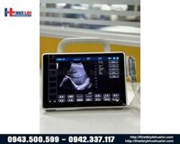 Máy siêu âm cầm tay giá rẻ - P10