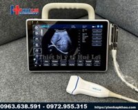 Máy siêu âm xách tay Doppler màu giá rẻ