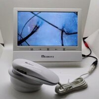 Máy soi da cầm tay IPAD màn hình 11inch 3 chế độ soi có chụp ảnh