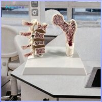 Mô hình bệnh loãng xương Femur Con người Công cụ giáo dục di động cho các buổi tập Lớp học Đồ dùng học tập Trình diễn