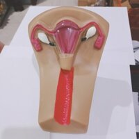 Mô hình đặt dụng cụ tử cung (hướng dẫn đặt vòng tránh thai)