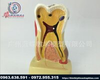 Mô hình hàm răng bệnh lý