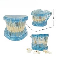 Mô Hình Hàm Răng Giải Trí Dành Cho Học Sinh Nha Khoa