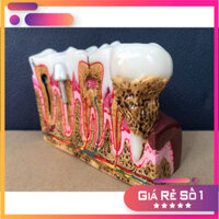 Mô Hình Hàm Răng Giảng Dạy Cho Nha Khoa