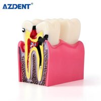 Mô hình răng hàm nha khoa 6 lần