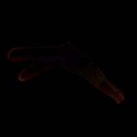 Mỏ Vịt Khám Phụ Khoa MedLife