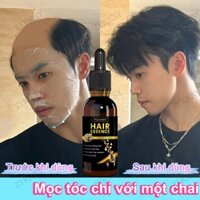 Mọc tóc mới trong 7 ngày thuốc kích mọc tóc nhanh thuốc mọc tóc thuốc mọc tóc nhanh cho nam kích mọc tóc nhật bản