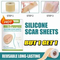 Mua 1 TẶNG 1 Miếng dán sửa chữa sẹo bằng Gel silicon tự dính 150cm Miếng dán sẹo