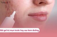 Nên bôi kem trị mụn trước hay sau kem dưỡng?