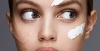 Nên dùng gel trị mụn hay kem trị mụn sẽ tốt cho da hơn?