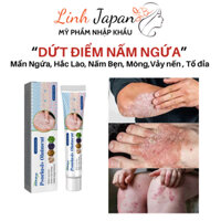 [Ngứa ghẻ lâu năm] Kem bôi da nấm ngứa tổ đỉa hắc lào mề đay á sừng vảy nến giảm ngứa sạch nấm 20g