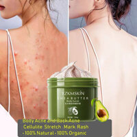 Niacinamide Shea Butter Oil Body Frosted Chicken Skin Tẩy da chết cho da mịn màng hơn và trắng hơn 250 g
