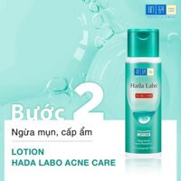 Nước Hoa Hồng Ngừa Mụn Cấp Ẩm Hada Labo Acne Care 170ml