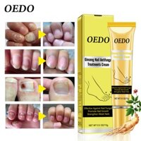 OEDO Kem chống nấm móng tay giúp tẩy lớp biểu bì dầu làm trắng và giúp móng phát triển khỏe mạnh hiệu quả nhanh chón không gây kích ứng - intl