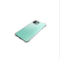 Ốp lưng dành cho Xiaomi Mi 11 Lite bảo vệ camera, dẻo trong suốt, chống va đập - Hàng nhập khẩu