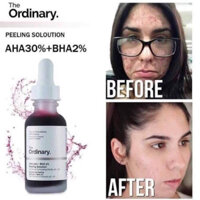 Peel da hoá học The Ordinary AHA