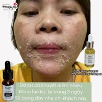 Peel Lột Da Mặt Tảo Biển - Tặng Serum B5 Phục Hồi Da Sau Peel