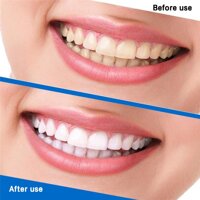 Professional Advanced Teeth Beauty Strips Tooth Bleaching White Strip