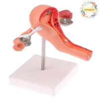 Pufanggreat 1 Cái Đạo Cụ Y Tế Mô Hình Bệnh Lý Uterus Ovary Mô Hình Giải Phẫu Phần Chữ Thập Dụng Cụ Học VN