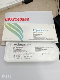 Que cấy tránh thai Implanon